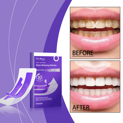 Professional Teeth Whitening Strips