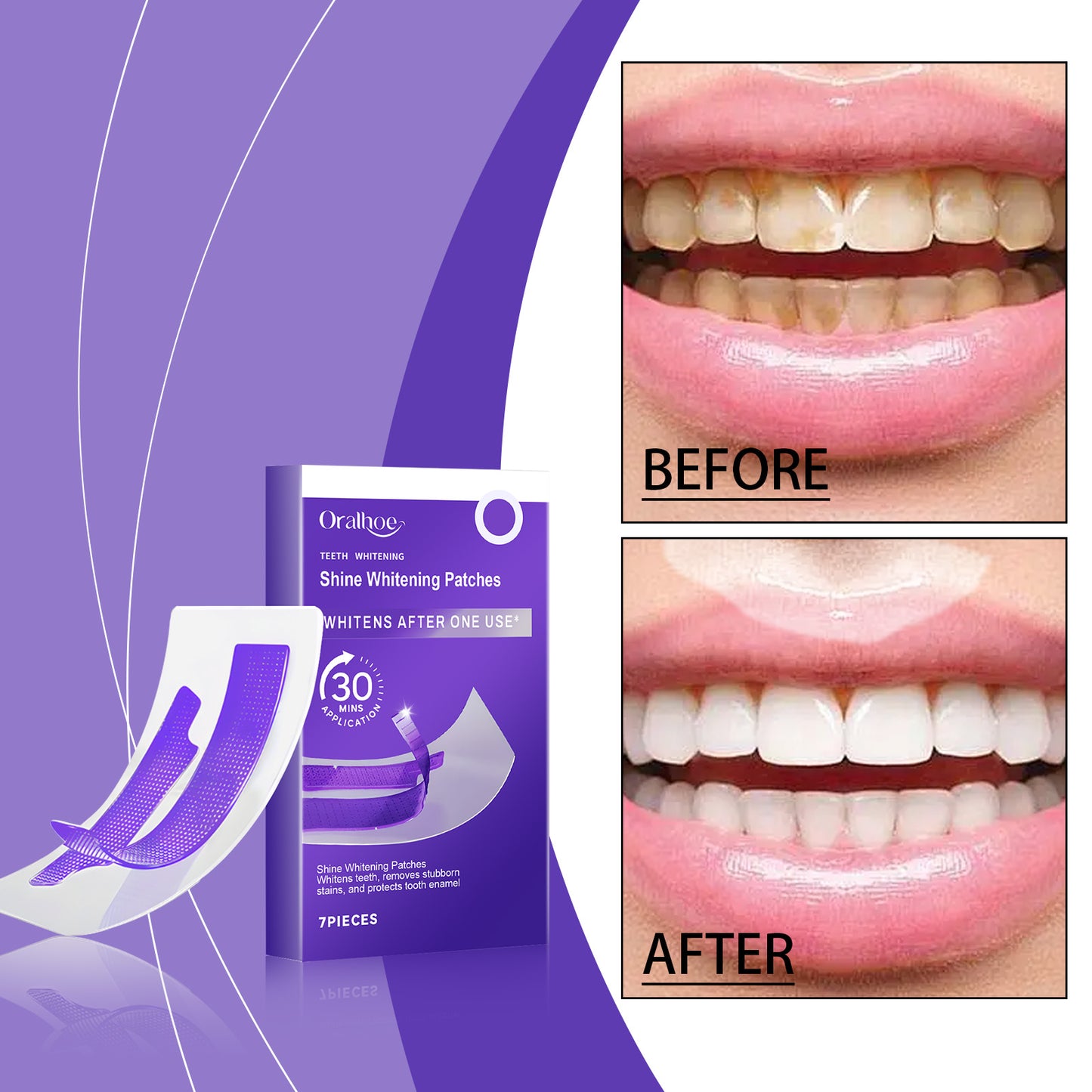 Professional Teeth Whitening Strips
