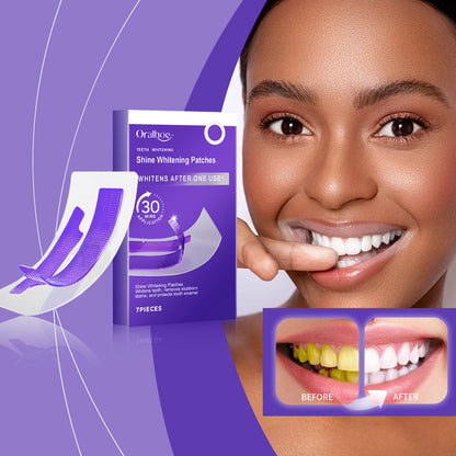 Professional Teeth Whitening Strips